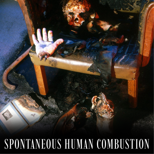 Spontaneous Human Combustion